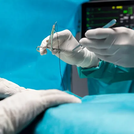 Gynaecological Surgery