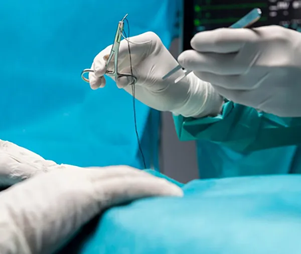 Wound Closure Products for Gynaecological Surgery